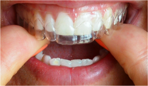 Picture4