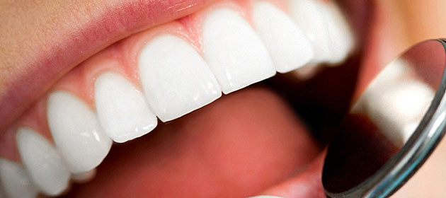 Settle strategy scald Licówki, czyli szybki sposób na piękne zęby | DentalDesign®